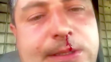 (VIDEO) Un candidat PSDE la parlamentare, bătut în plină stradă de un consilier PAS din Hâncești