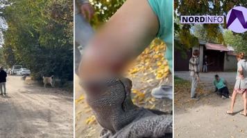 https://nordinfo.md/video-o-femeie-din-balti-s-a-ales-cu-rani-grave-dupa-ce-a-fost-atacata-de-un-caine